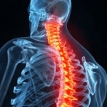 Trusted Apache County Attorneys for Back and Neck Injuries After Car Crashes image