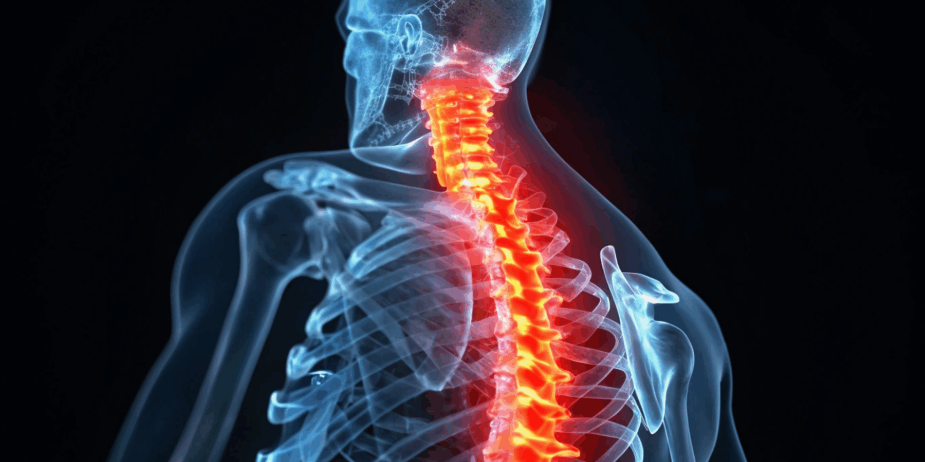 Trusted Apache County Attorneys for Back and Neck Injuries After Car Crashes image